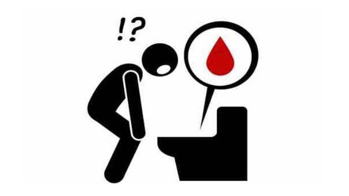 مشاهده خون روی کاسه توالت